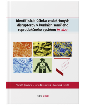 Identifikácia účinku endokrinných disruptorov v bunkách samčieho reprodukčného systému in vitro
