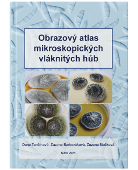 Obrazový atlas mikroskopických vláknitých húb